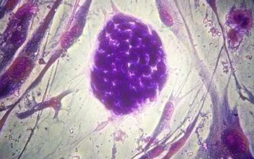 干细胞